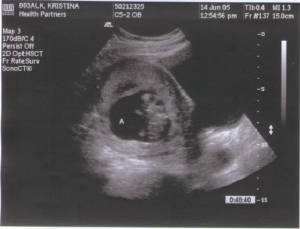 babya11wks.jpg